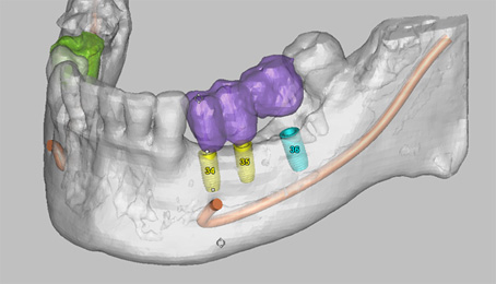 Implantologisch ttige Zahnarztpraxis